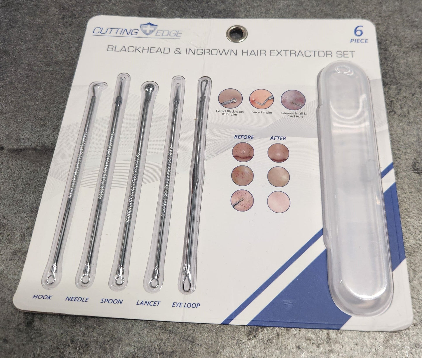 Blackhead & Ingrown Hair Extractor Set – Professional Stainless Steel Tools for Clear Skin - Unrestricted Goods