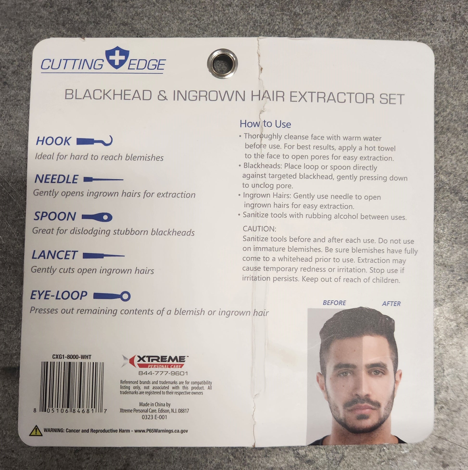 Blackhead ingrown hair extractor set unrestricted goods